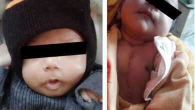 Two newborns with rare heart condition undergo arterial switch operation at Amrita Hospital, Faridabad