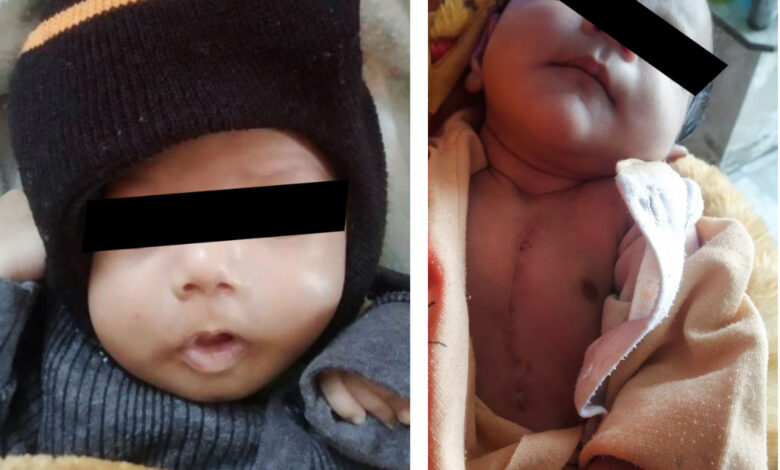 Two newborns with rare heart condition undergo arterial switch operation at Amrita Hospital, Faridabad